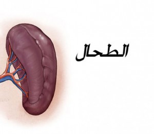splenectomy_def_2135_1